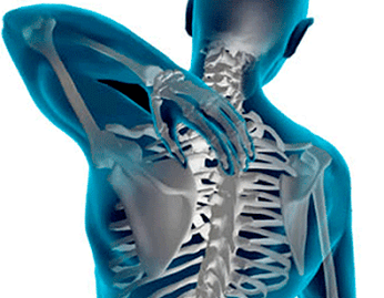Manifestations of osteoarthritis of the chest spine