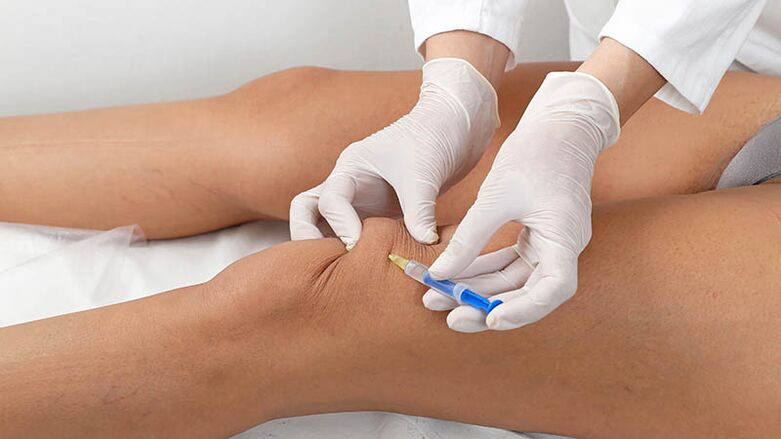 Organ injection for knee arthritis